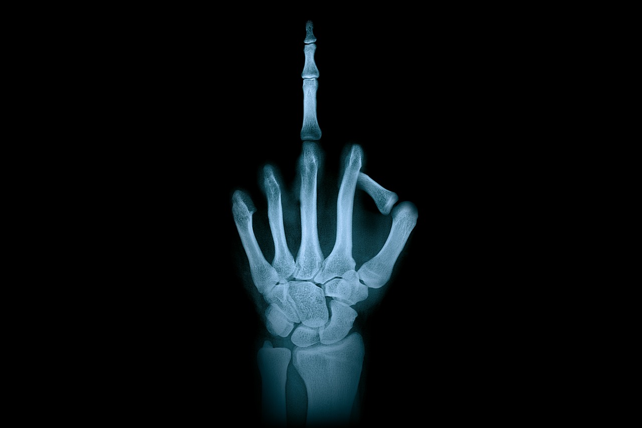 ¿Cuáles son los tipos de aparatos de rayos X de equipos odontologicos?